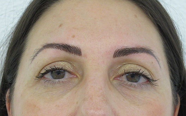 Micropigmentación Mallorca Cejas Centro: Después