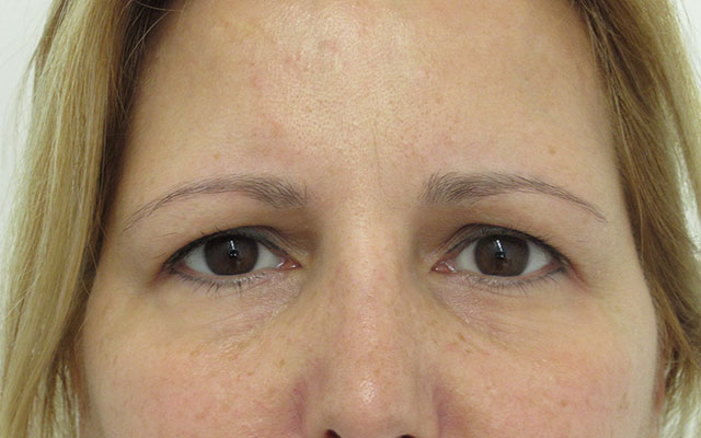 Micropigmentación Mallorca Cejas Centro
