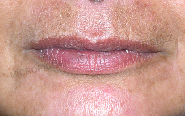 Micropigmentación Mallorca Labial Labios