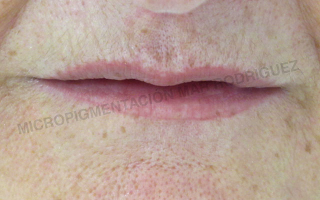 Micropigmentación Mallorca Labial Labios