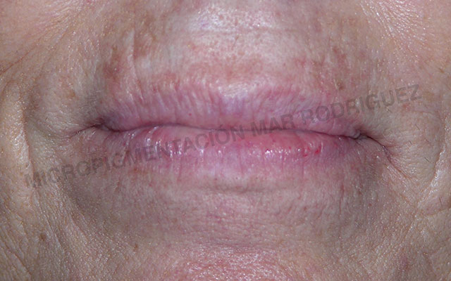 Micropigmentación Mallorca Labial Labios