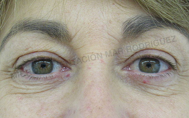 Micropigmentación Mallorca Ojos Centro