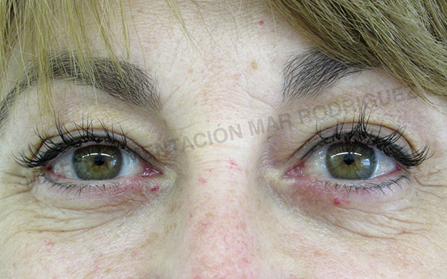 Micropigmentación Mallorca Ojos Centro