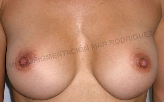 Micropigmentación Mallorca Paramédico  Centro